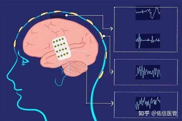 基于嵌入式处理器的智能制造_嵌入式应用创新_基于嵌入式linux的智能手机应用系统研究